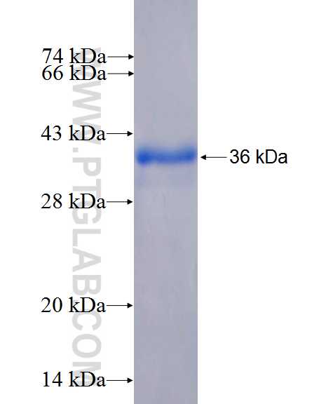 HE4 fusion protein Ag26631 SDS-PAGE