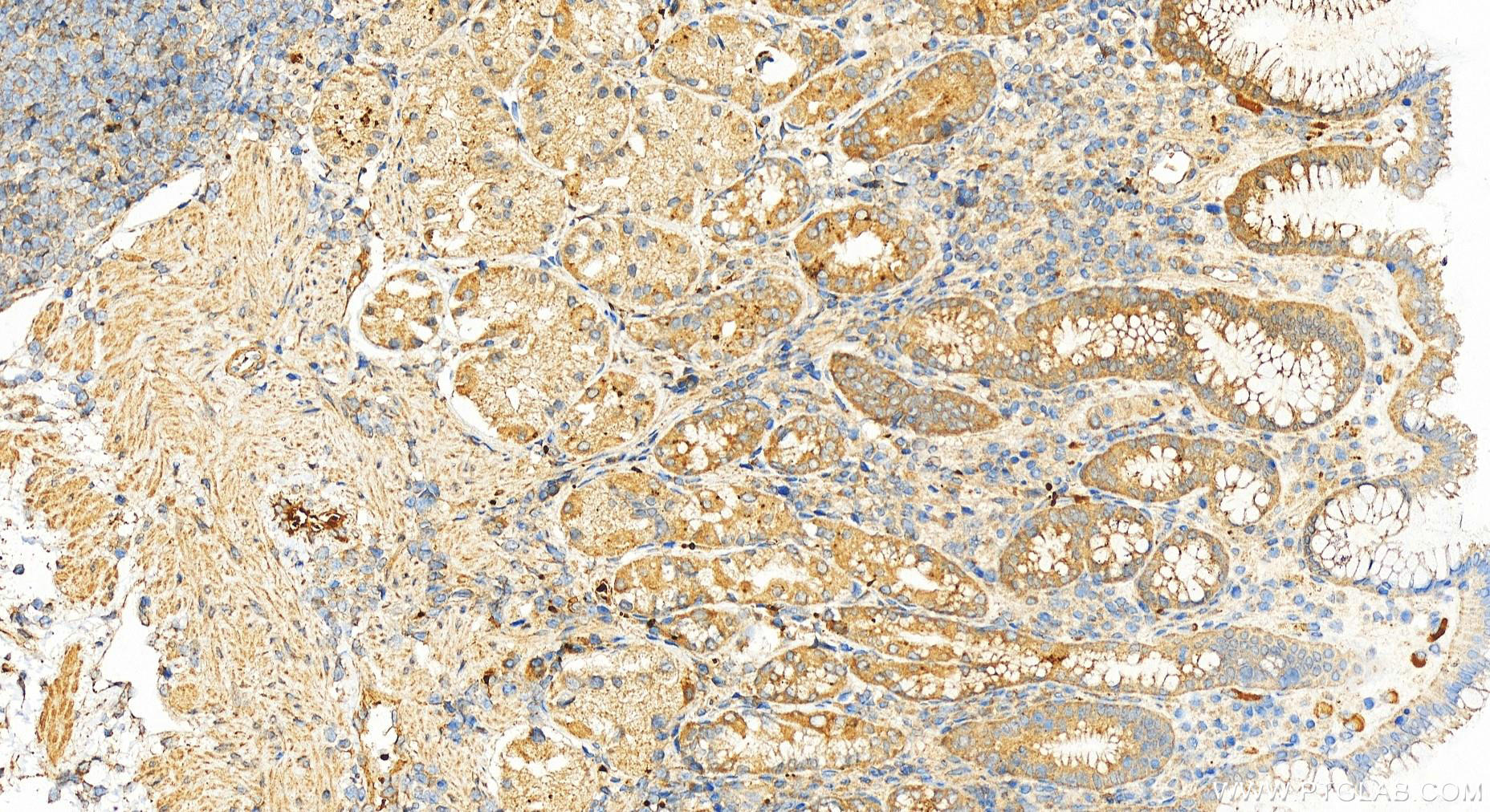 IHC staining of human stomach using 24578-1-AP