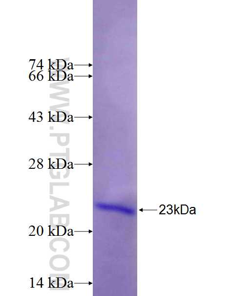 HEATR3 fusion protein Ag26335 SDS-PAGE