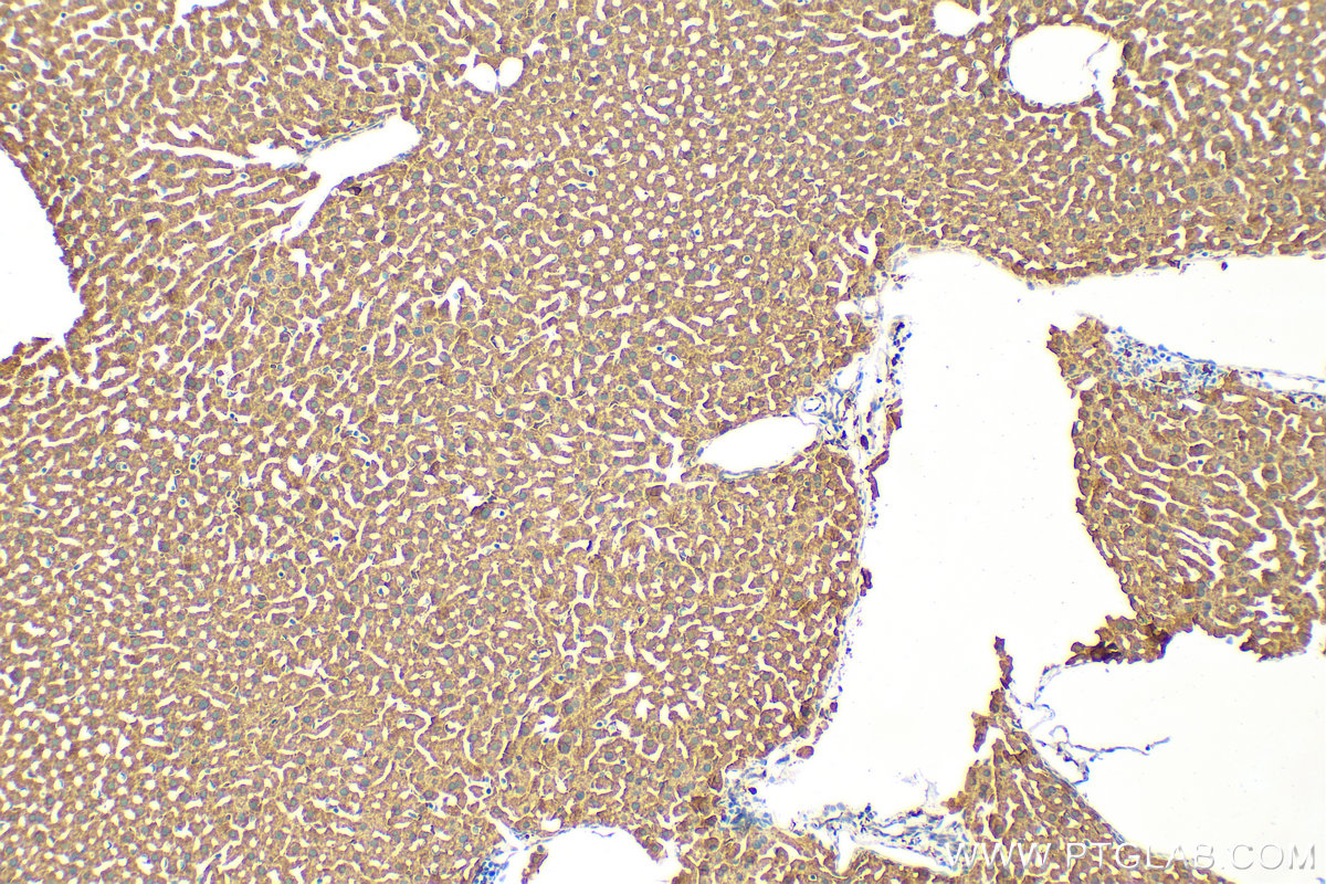 IHC staining of mouse liver using 82950-1-RR (same clone as 82950-1-PBS)