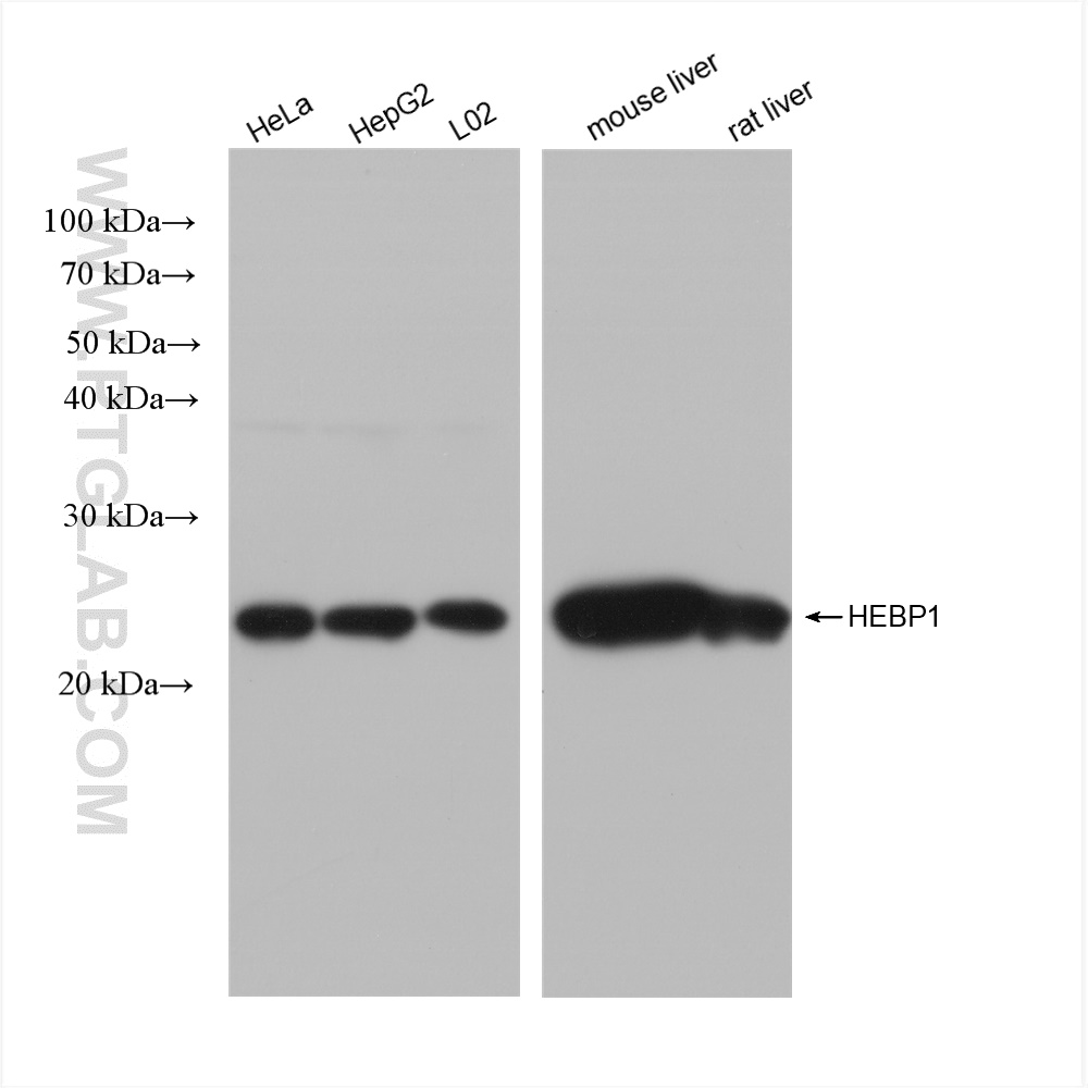 WB analysis using 82950-1-RR (same clone as 82950-1-PBS)