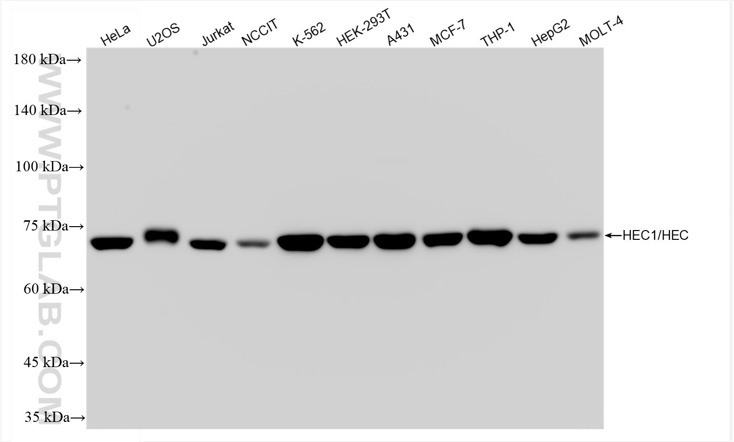 WB analysis using 83859-1-RR