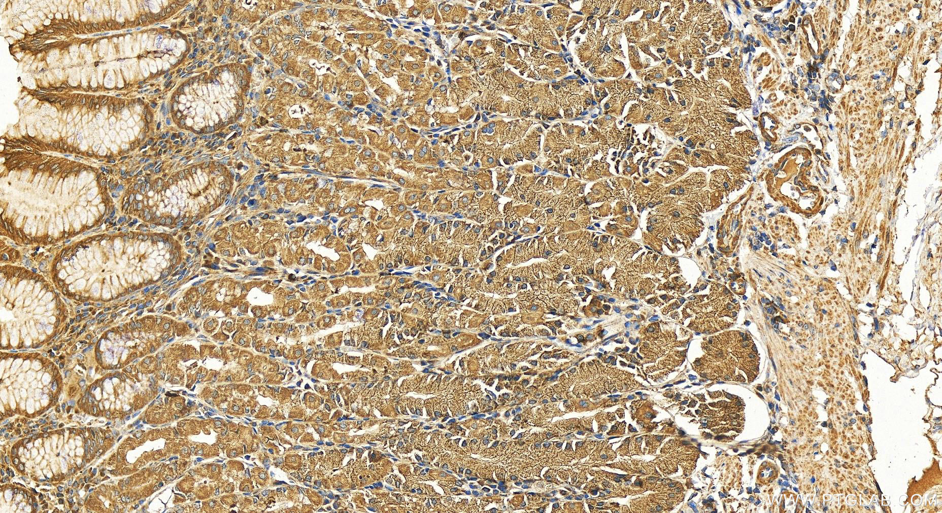 IHC staining of human stomach using 11487-1-AP