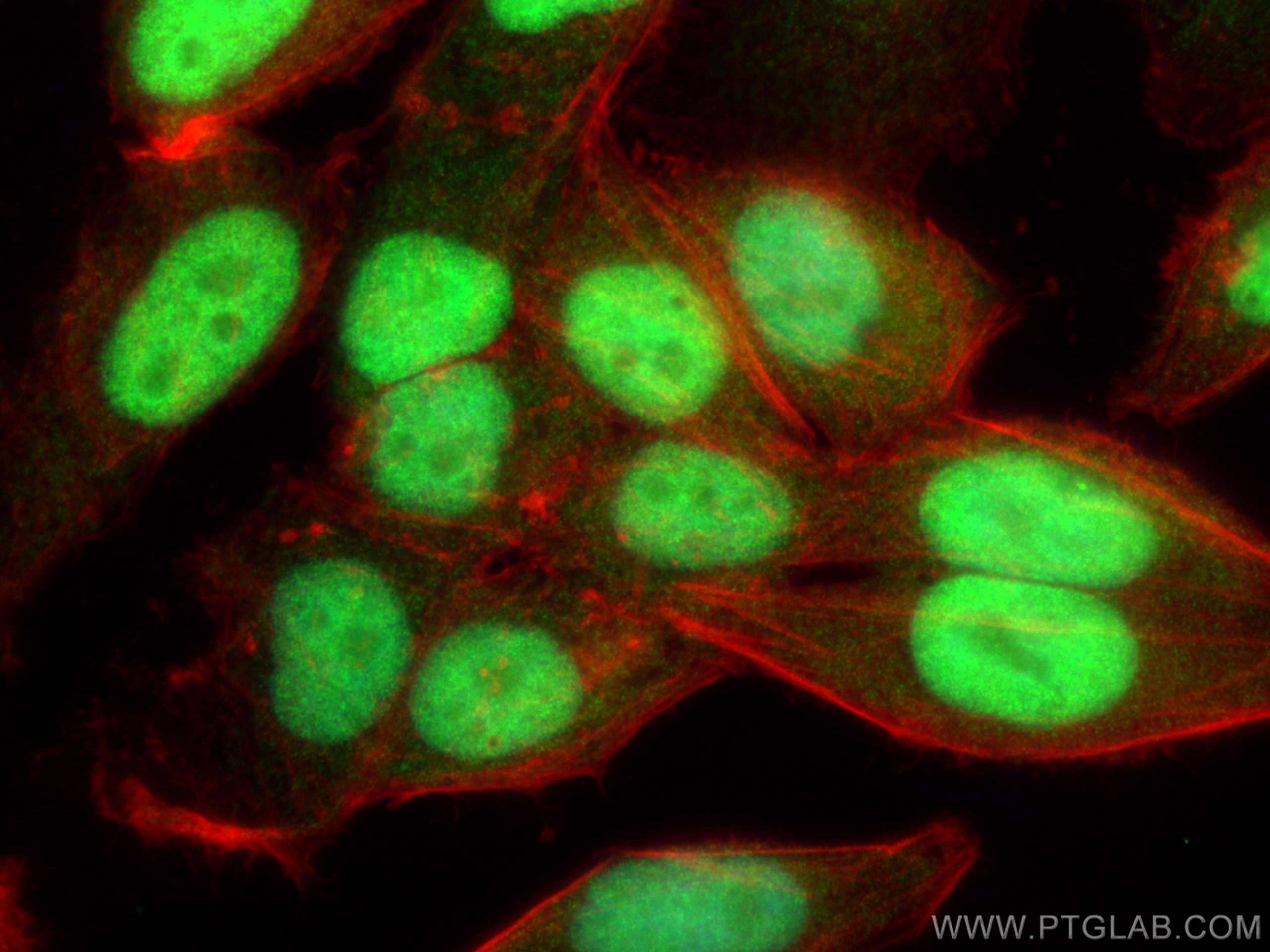 IF Staining of HepG2 using 11955-1-AP