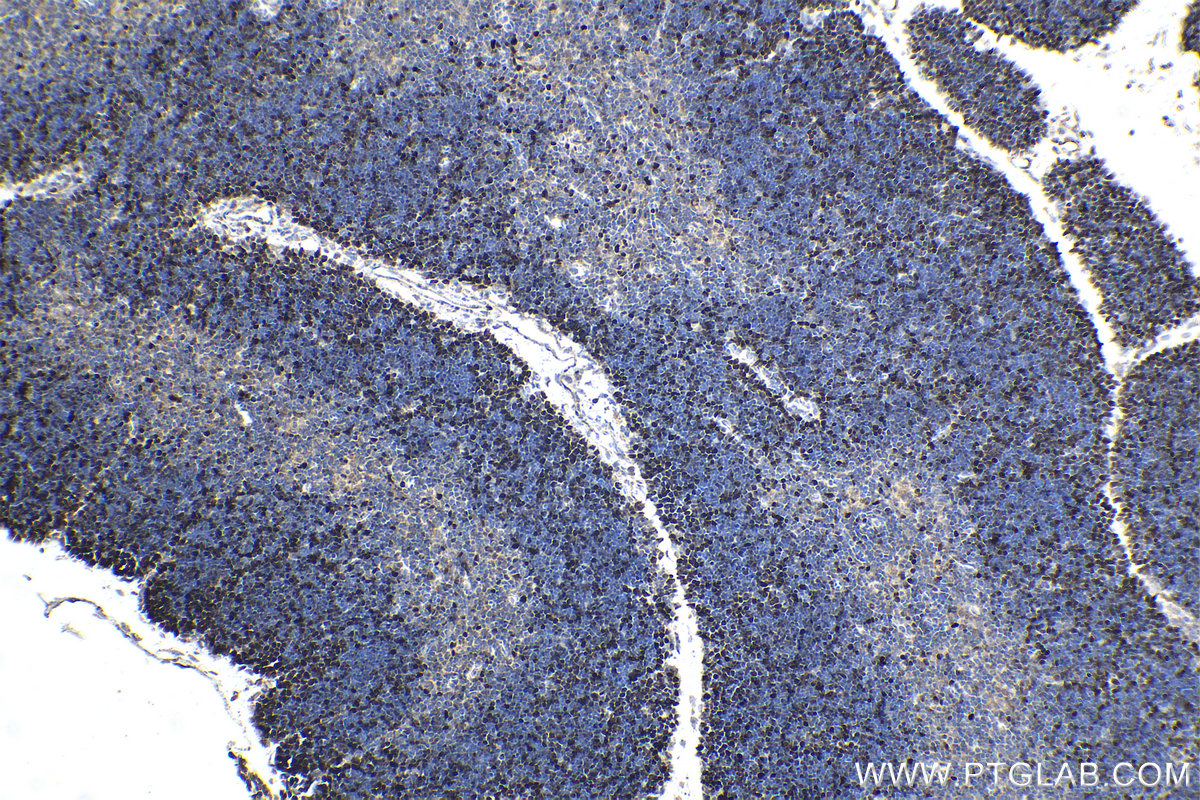 IHC staining of mouse thymus using 11955-1-AP