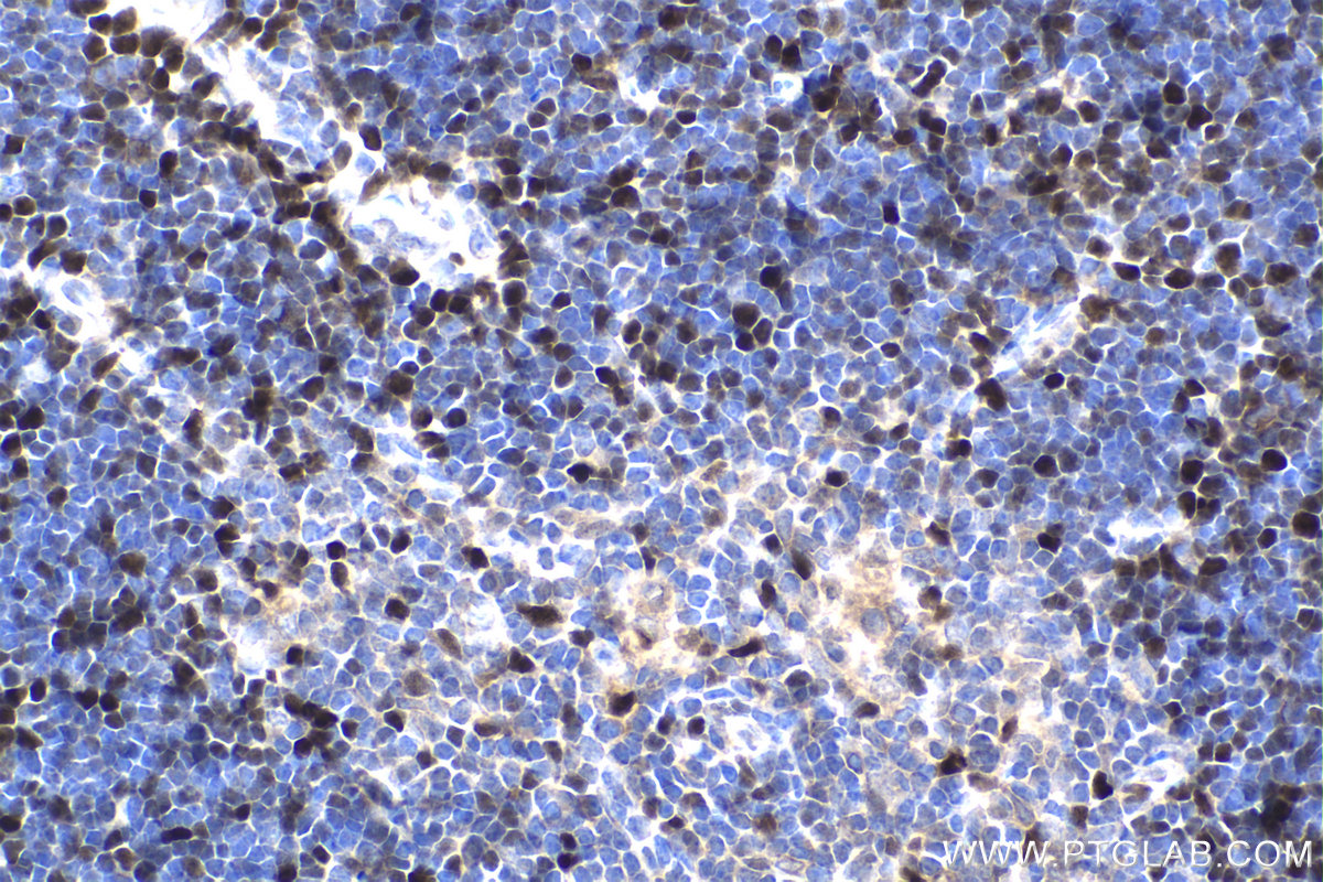 IHC staining of mouse thymus using 11955-1-AP