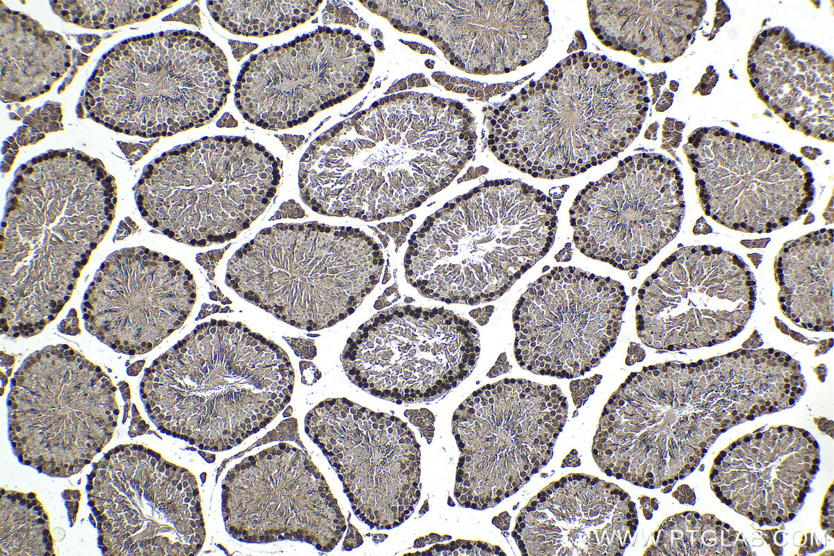 IHC staining of mouse testis using 11955-1-AP