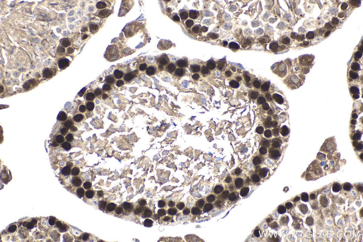 IHC staining of mouse testis using 11955-1-AP