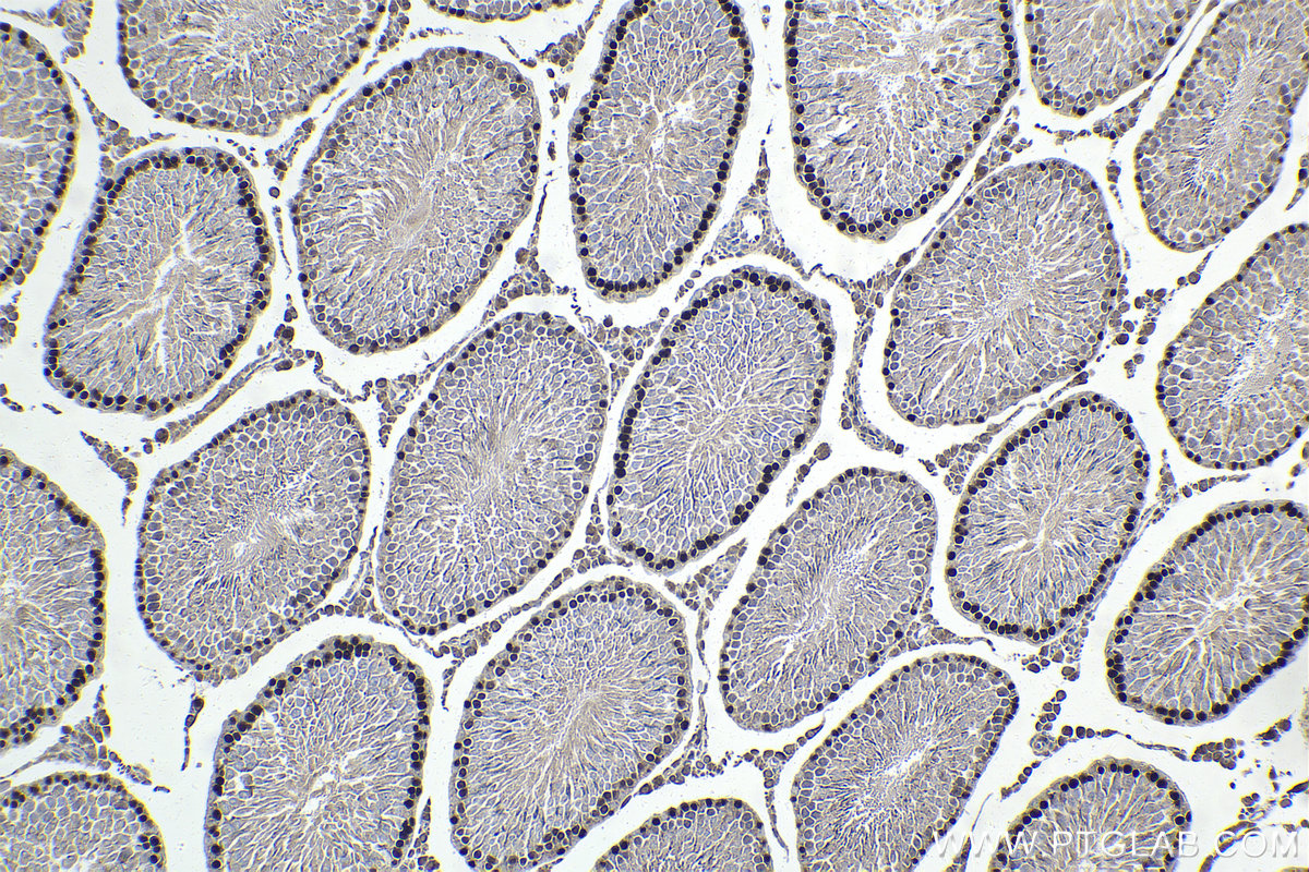 IHC staining of rat testis using 11955-1-AP