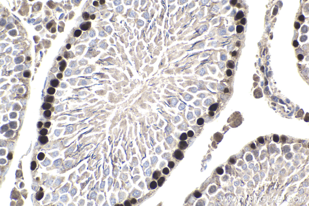 IHC staining of rat testis using 11955-1-AP