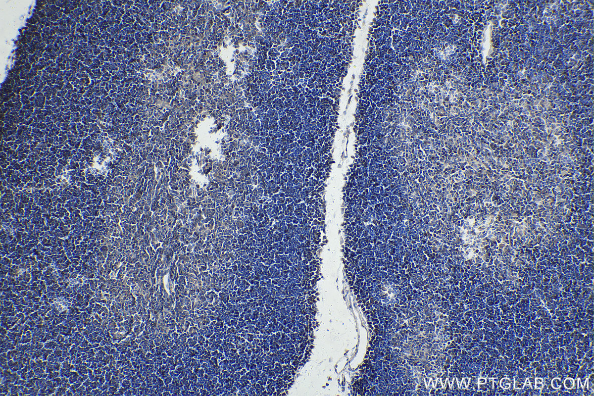 IHC staining of rat thymus using 11955-1-AP