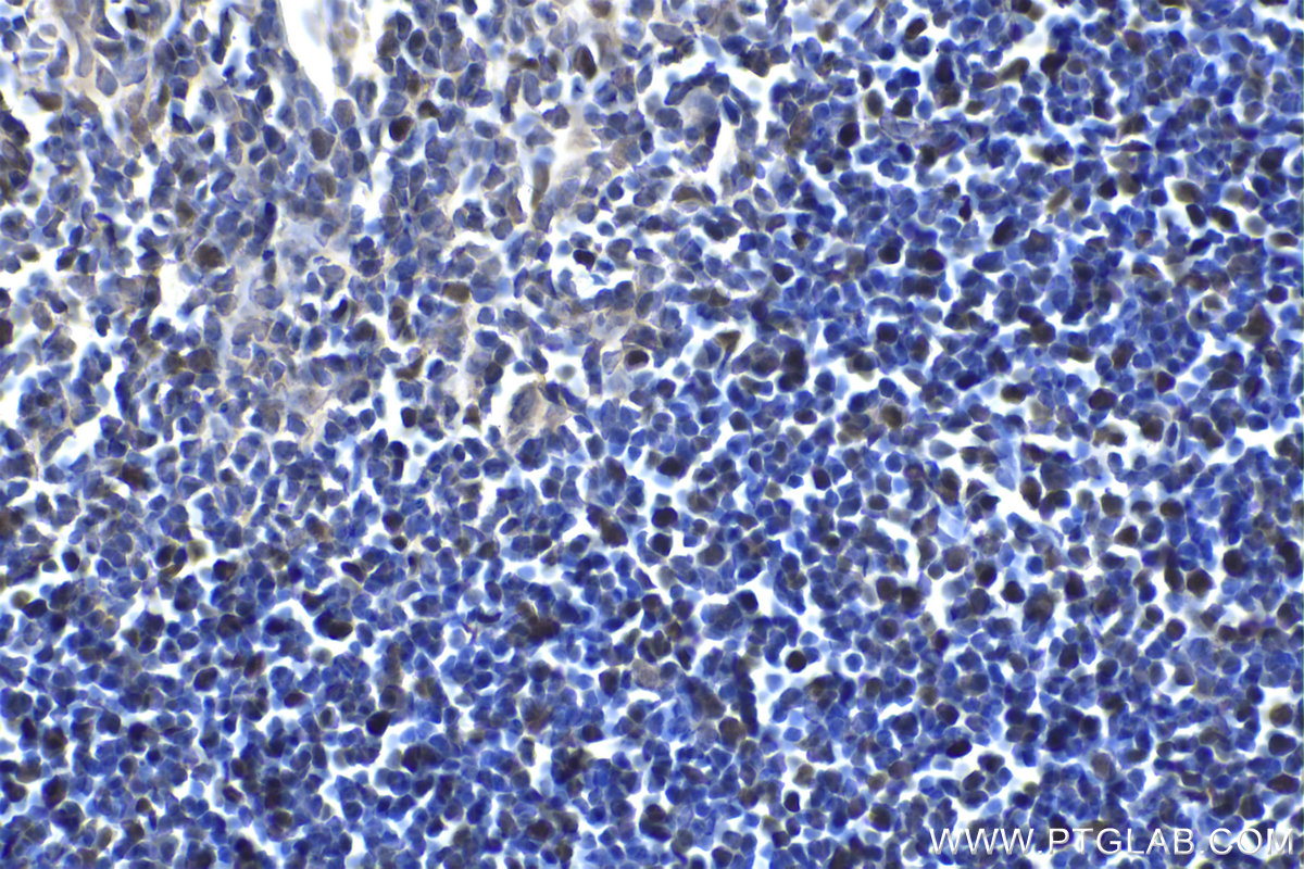 IHC staining of rat thymus using 11955-1-AP