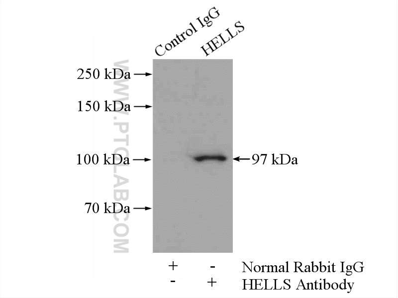 IP experiment of mouse testis using 11955-1-AP