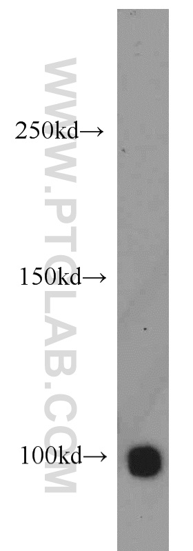 WB analysis of K-562 using 11955-1-AP