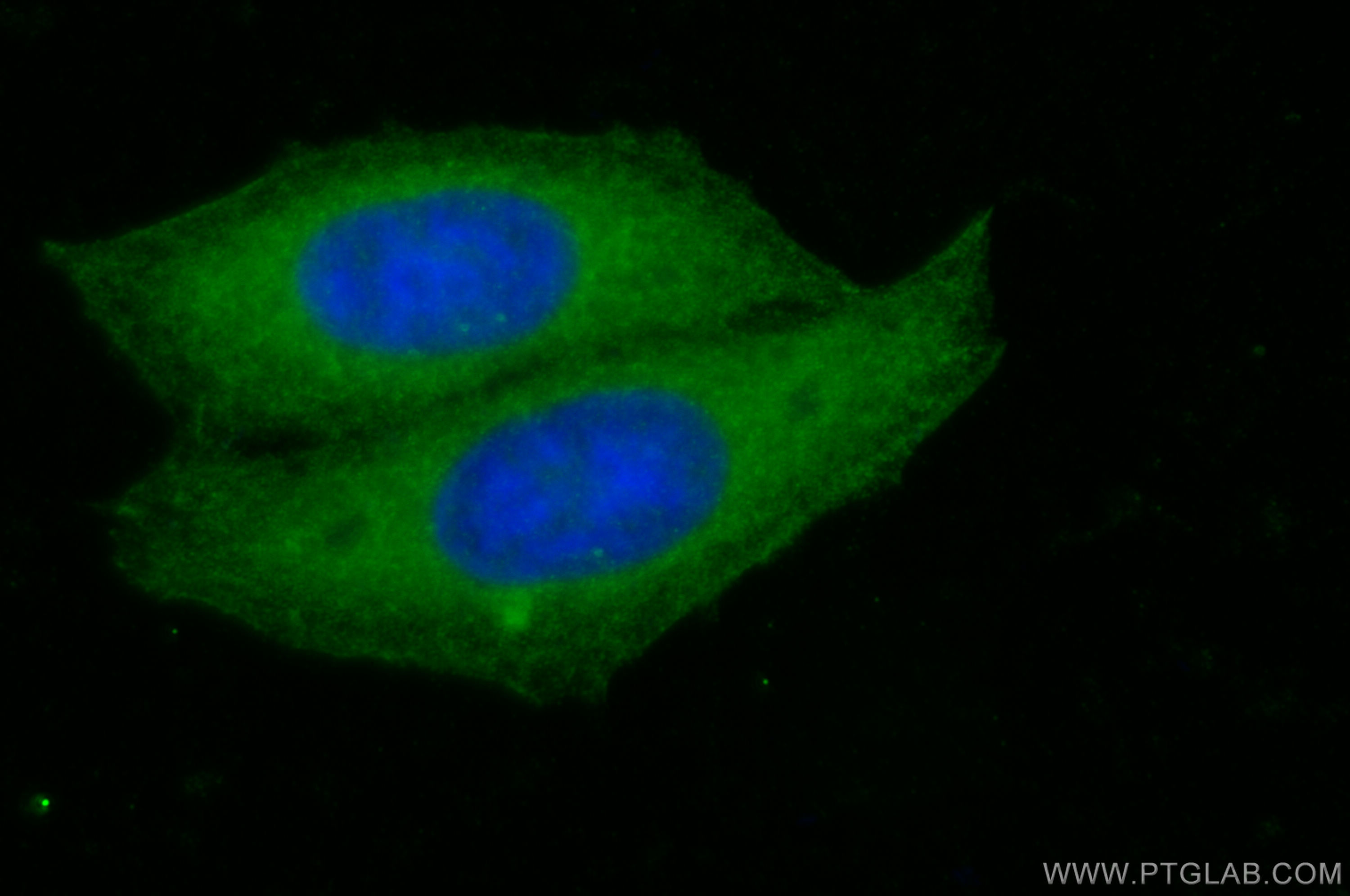 IF Staining of HepG2 using 26635-1-AP