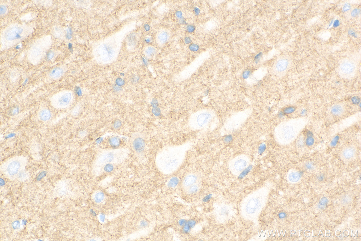 IHC staining of rat brain using 18177-1-AP