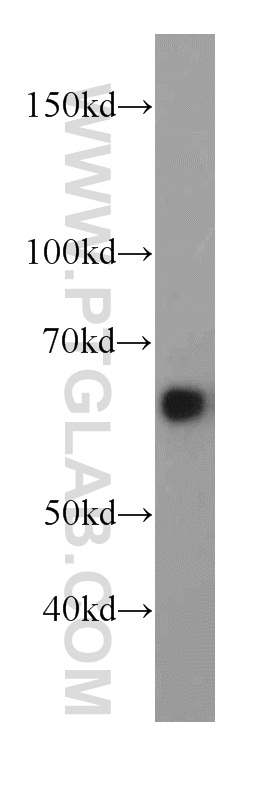 WB analysis of mouse brain using 18177-1-AP