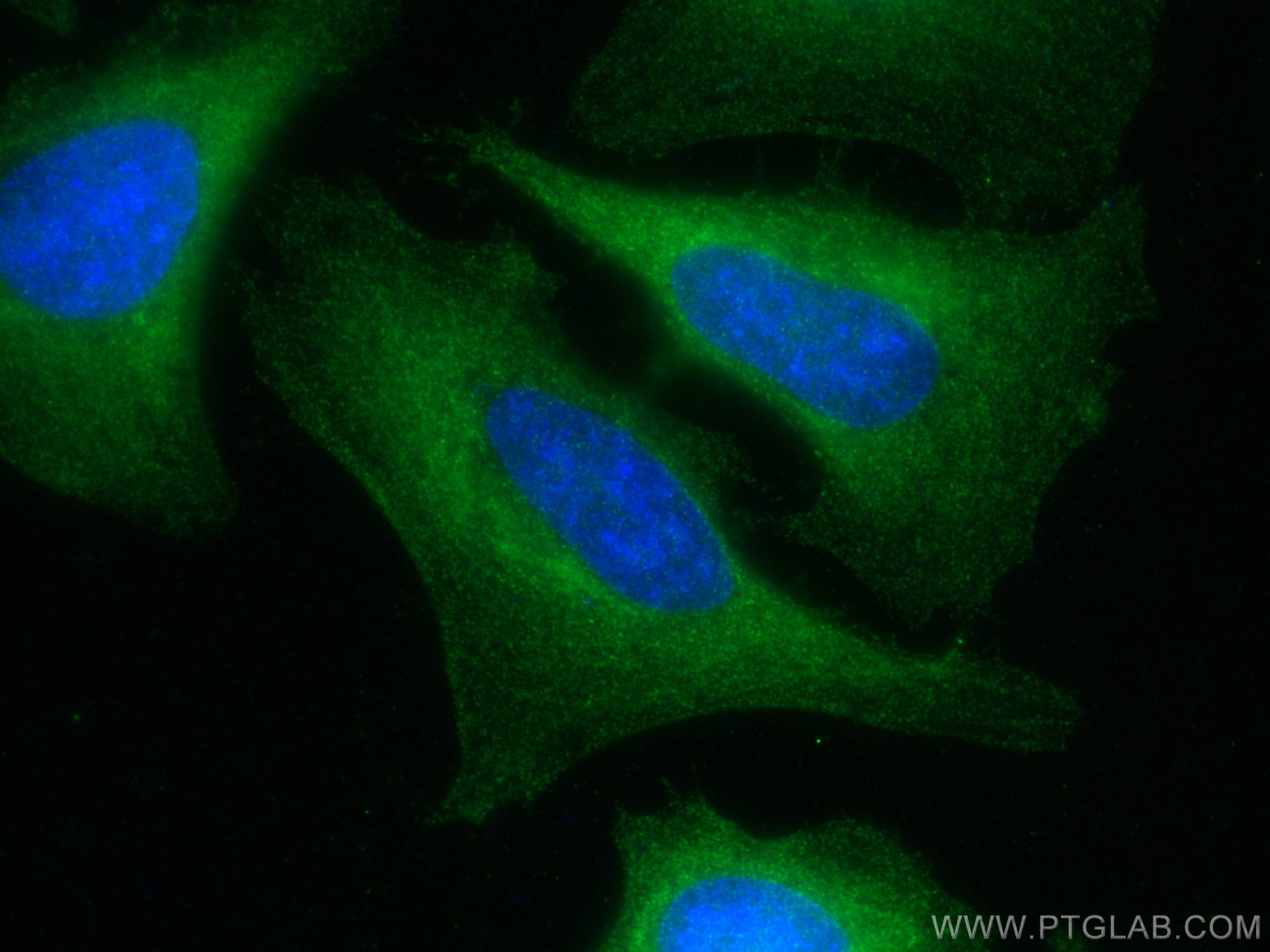 IF Staining of HeLa using 13691-1-AP