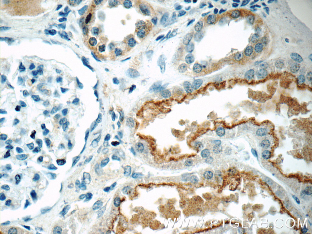 IHC staining of human kidney using 20640-1-AP