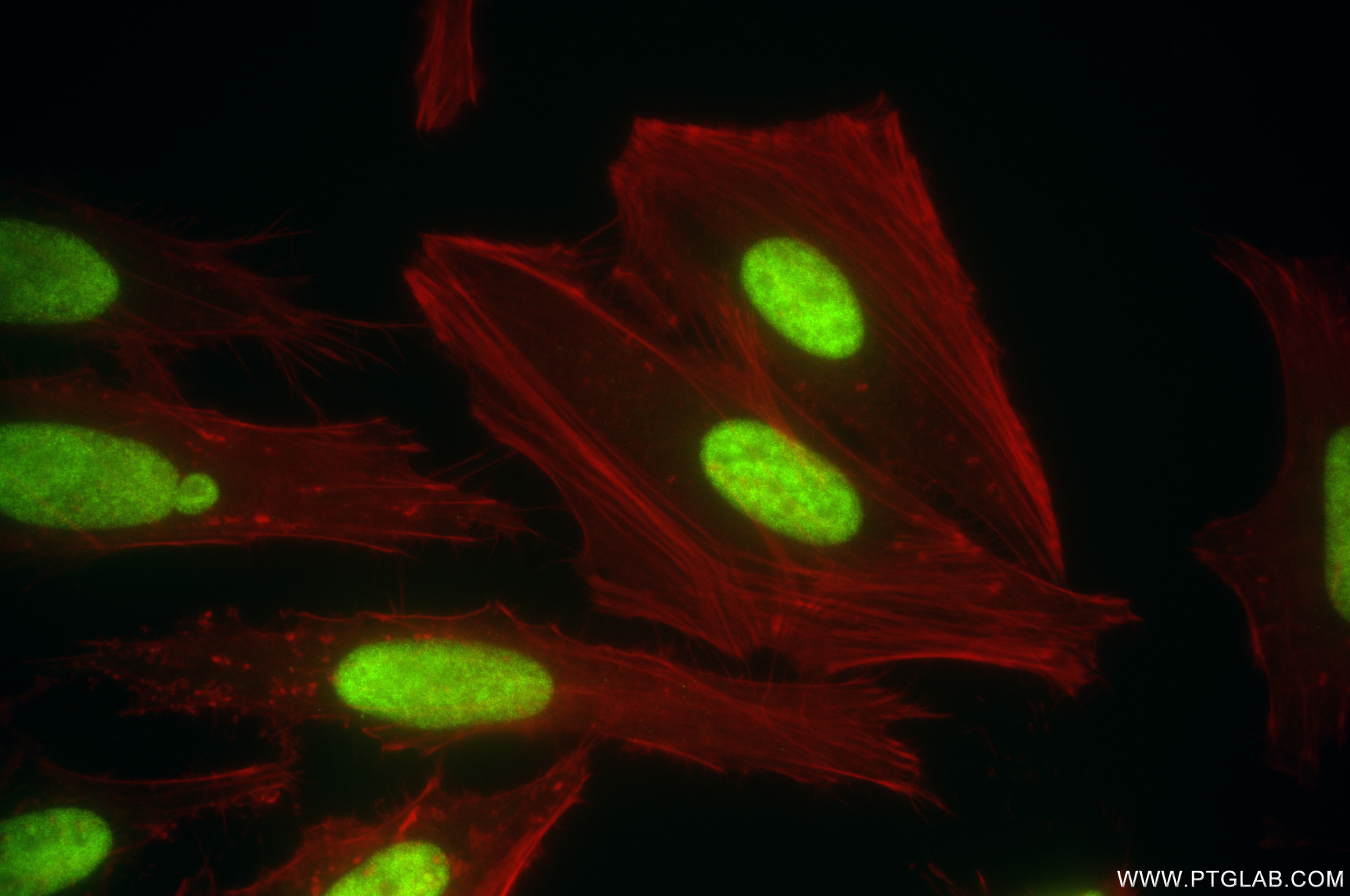 IF Staining of HeLa using 85028-1-RR (same clone as 85028-1-PBS)