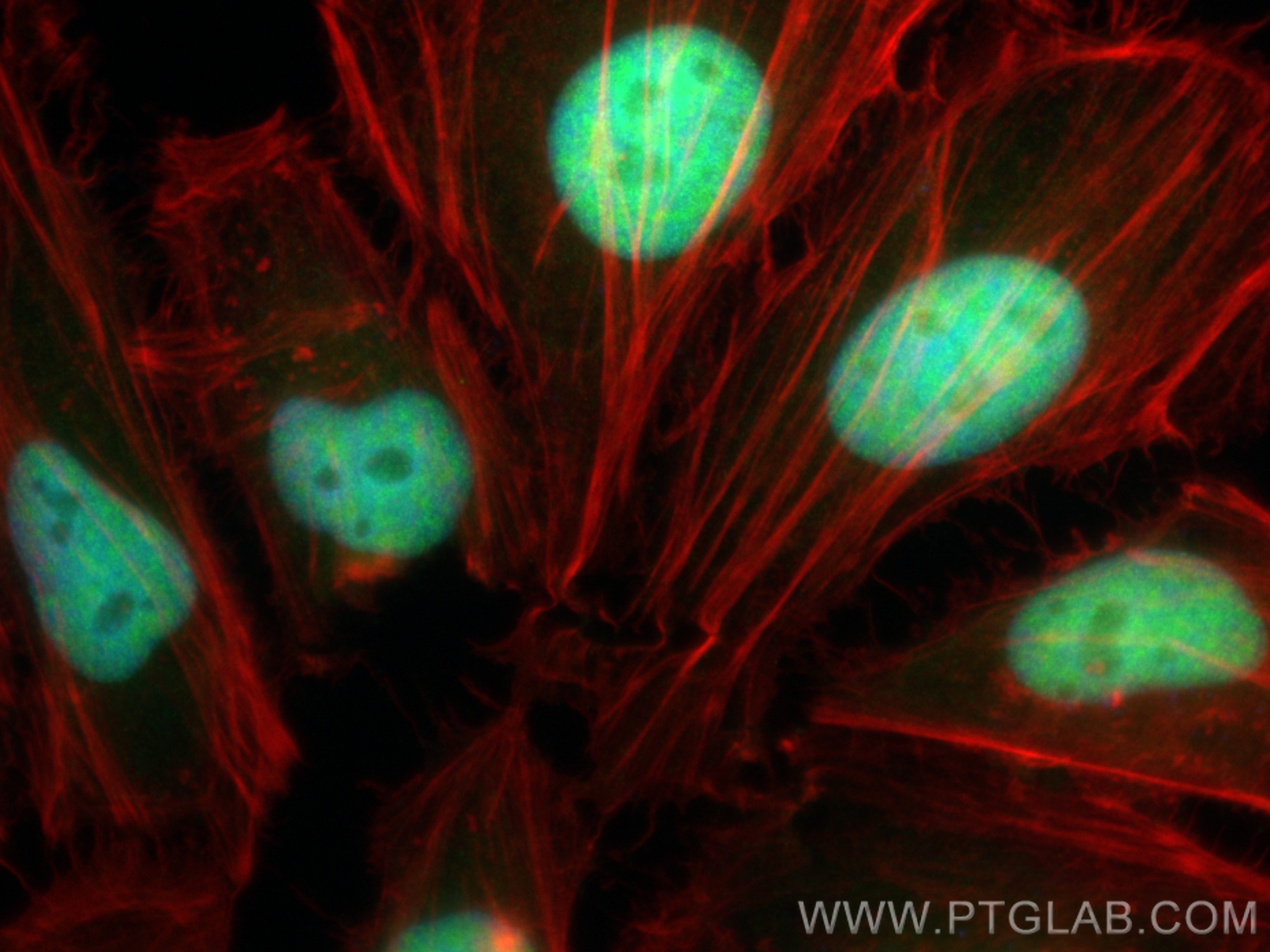 IF Staining of HeLa using CL488-15676