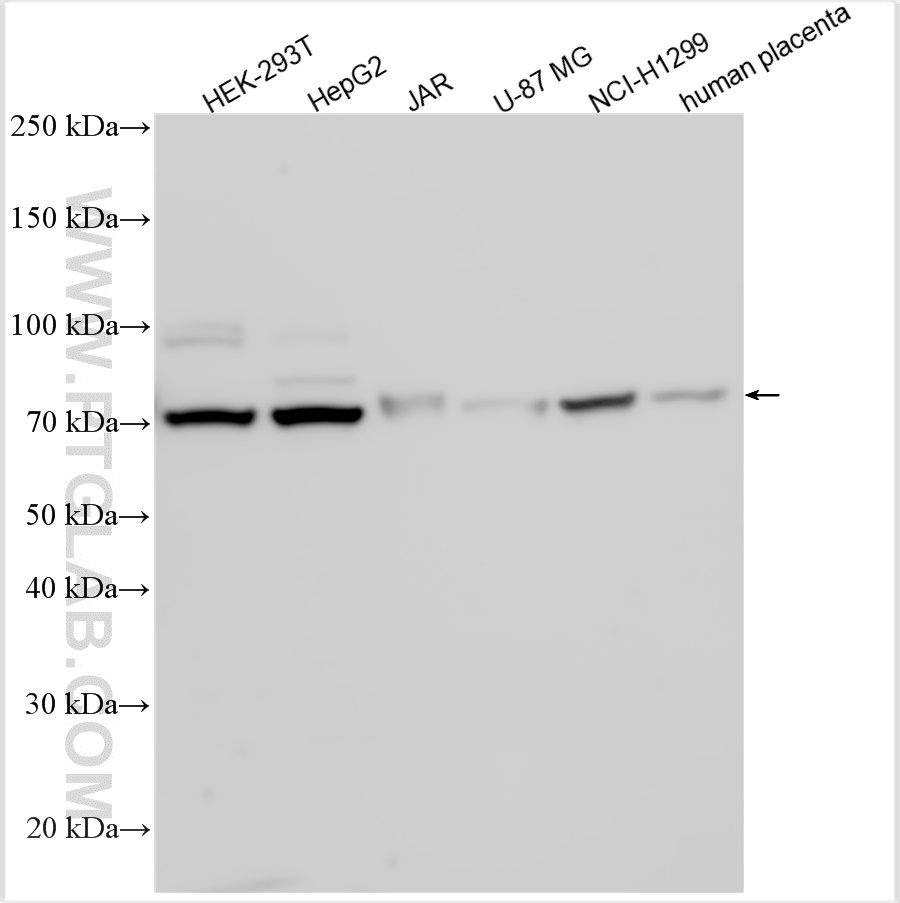 WB analysis using 26881-1-AP