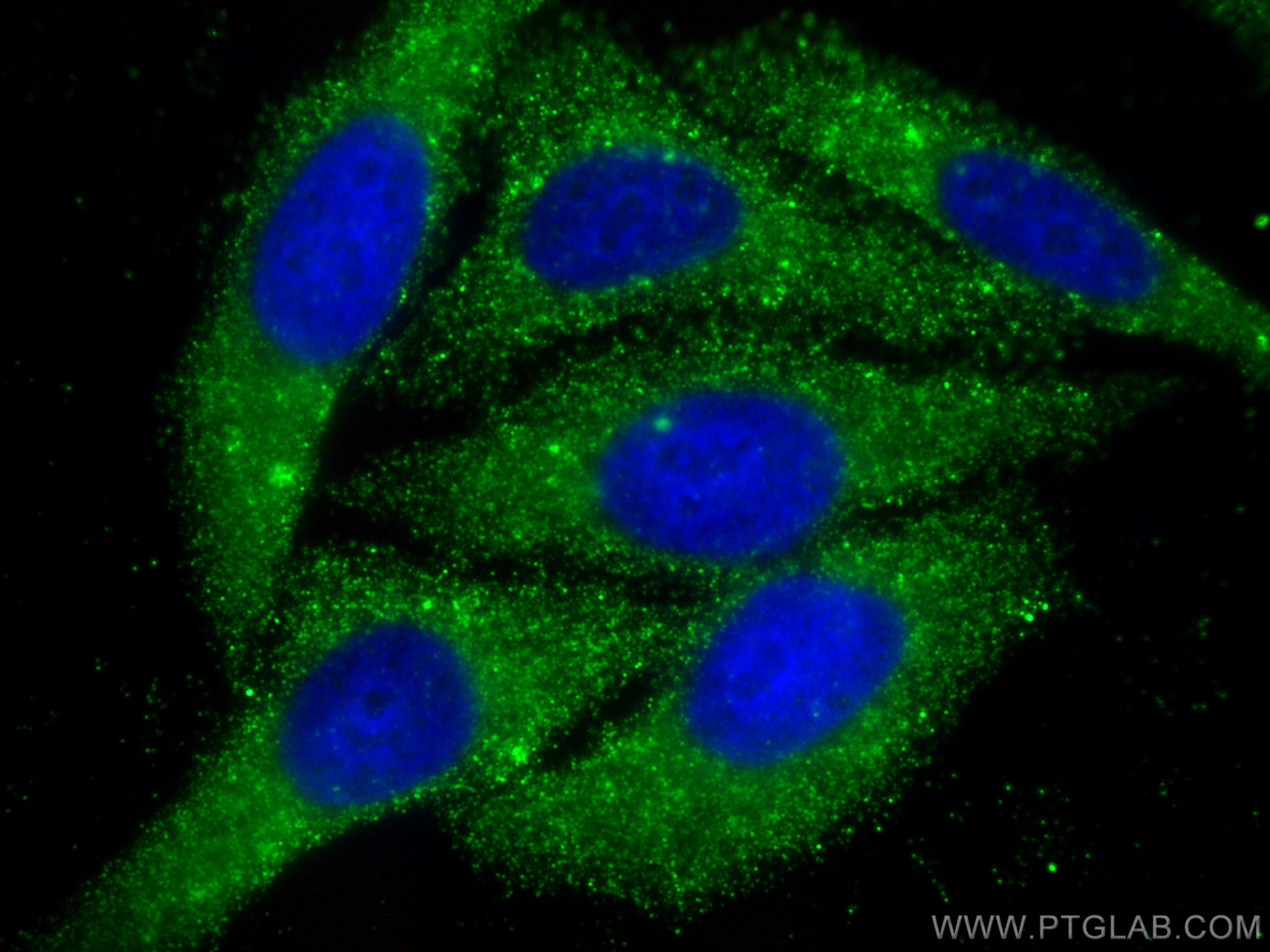 IF Staining of HepG2 using 67818-1-Ig (same clone as 67818-1-PBS)