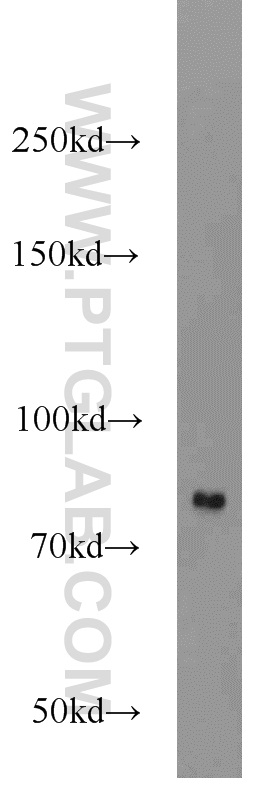 WB analysis of HEK-293 using 11654-1-AP