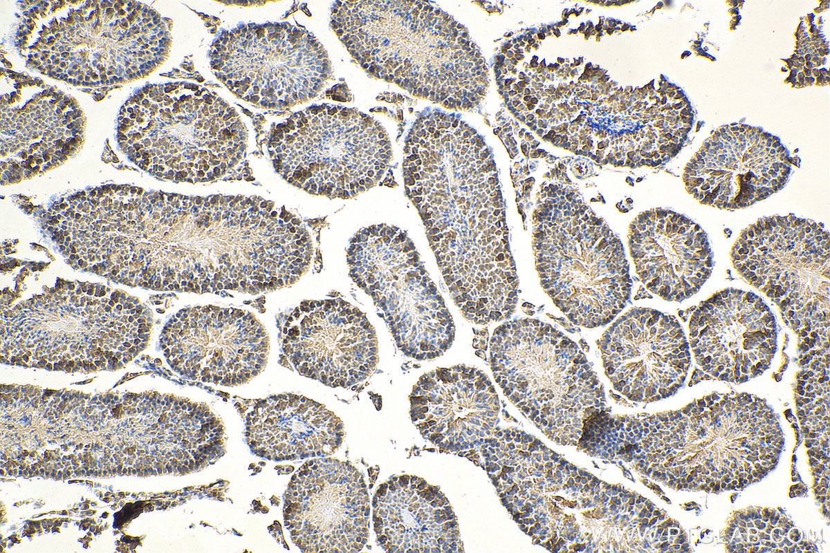 IHC staining of mouse testis using 29466-1-AP