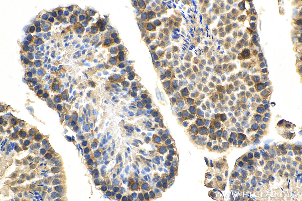 IHC staining of mouse testis using 29466-1-AP