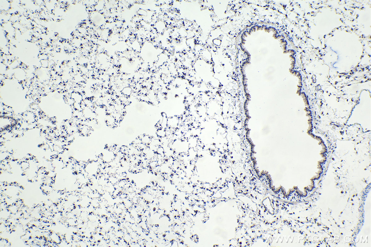 IHC staining of rat lung using 24949-1-AP