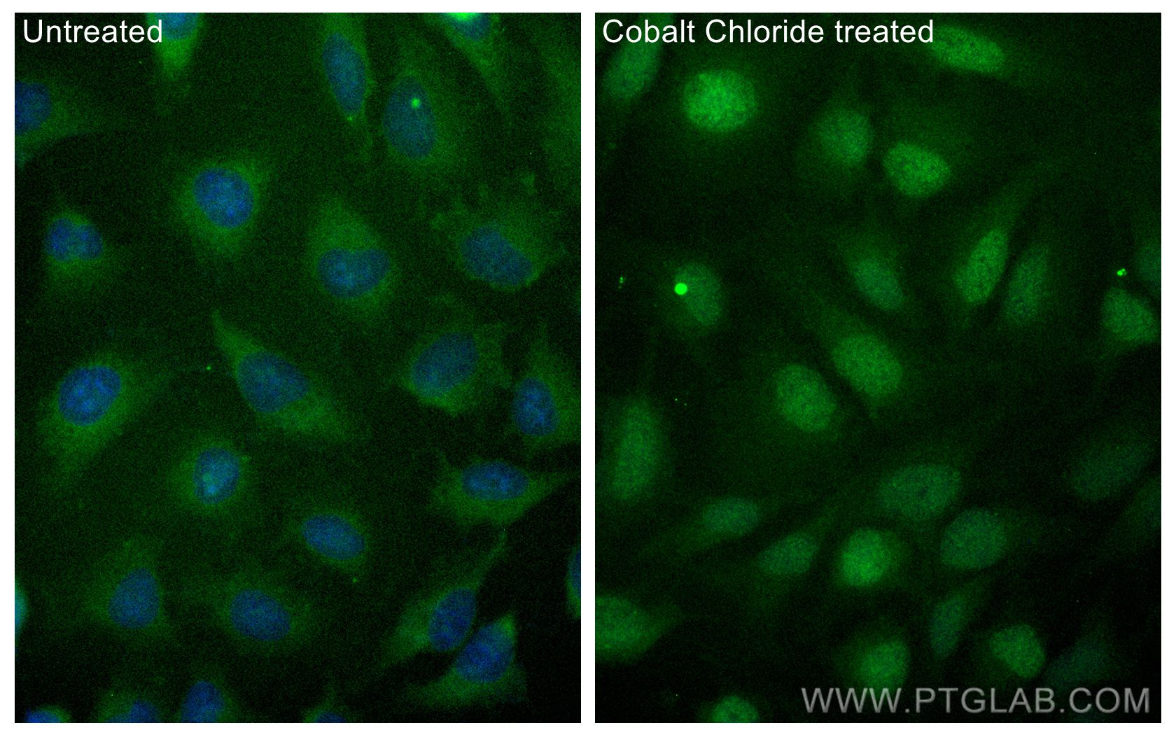 IF Staining of HeLa using FITC-20960