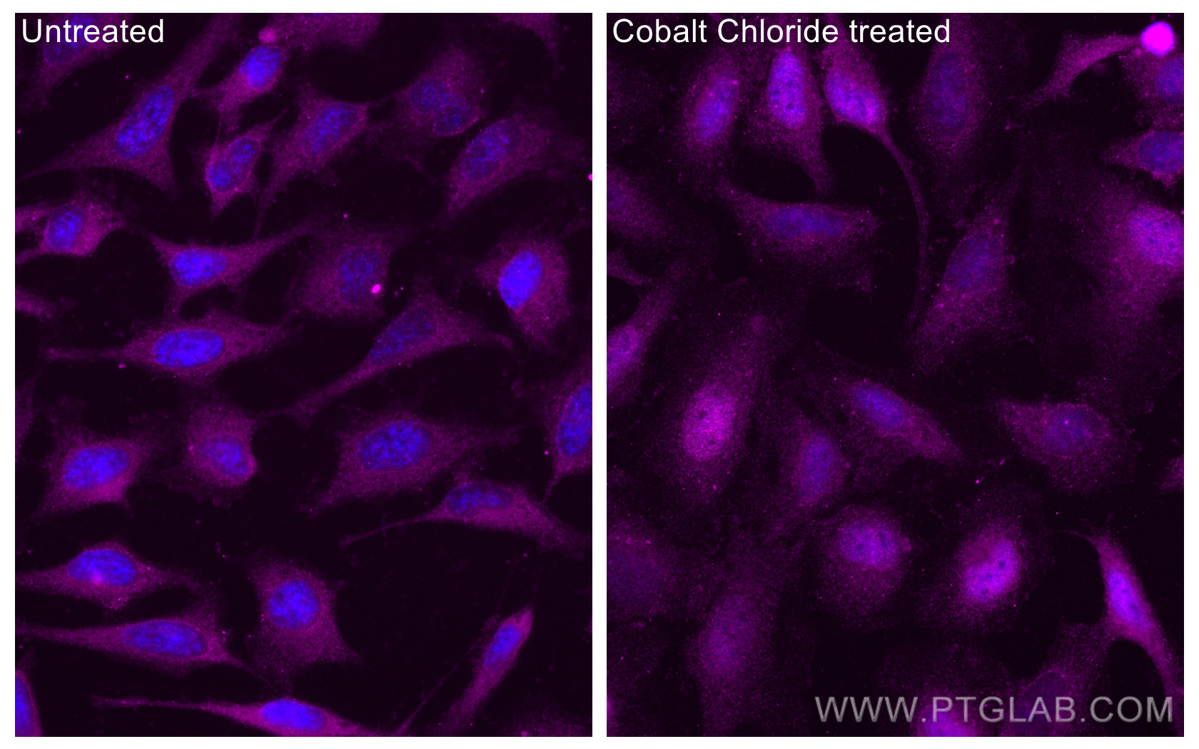 IF Staining of HeLa using CL647-20960