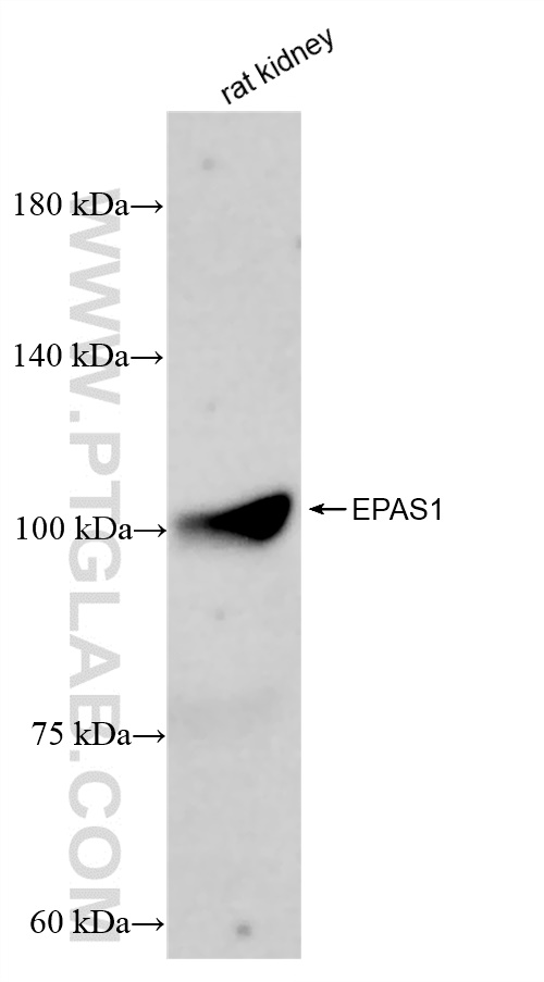 WB analysis of rat kidney using 83790-1-RR (same clone as 83790-1-PBS)