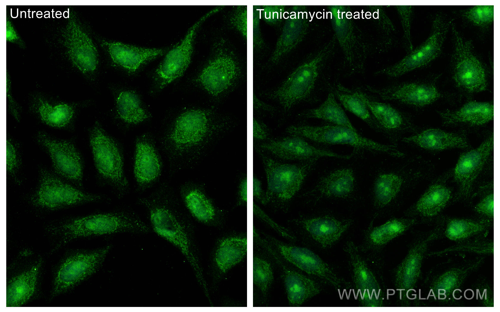 IF Staining of HeLa using 27650-1-AP