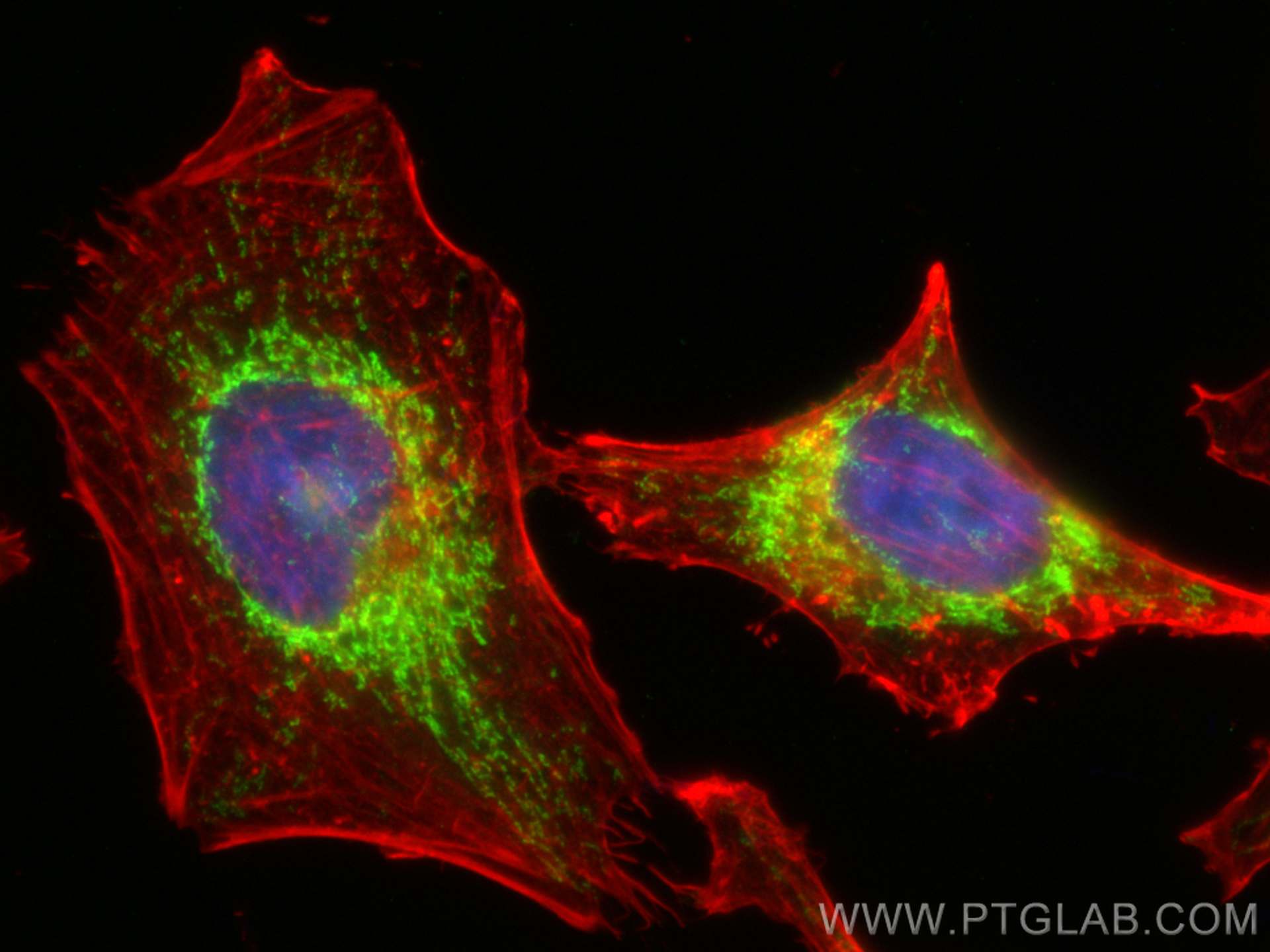 IF Staining of HeLa using 17986-1-AP