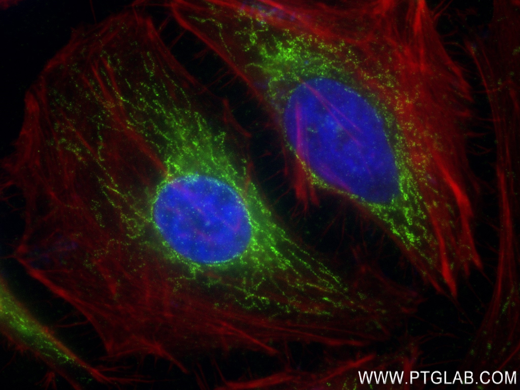 IF Staining of HeLa using 84031-5-RR