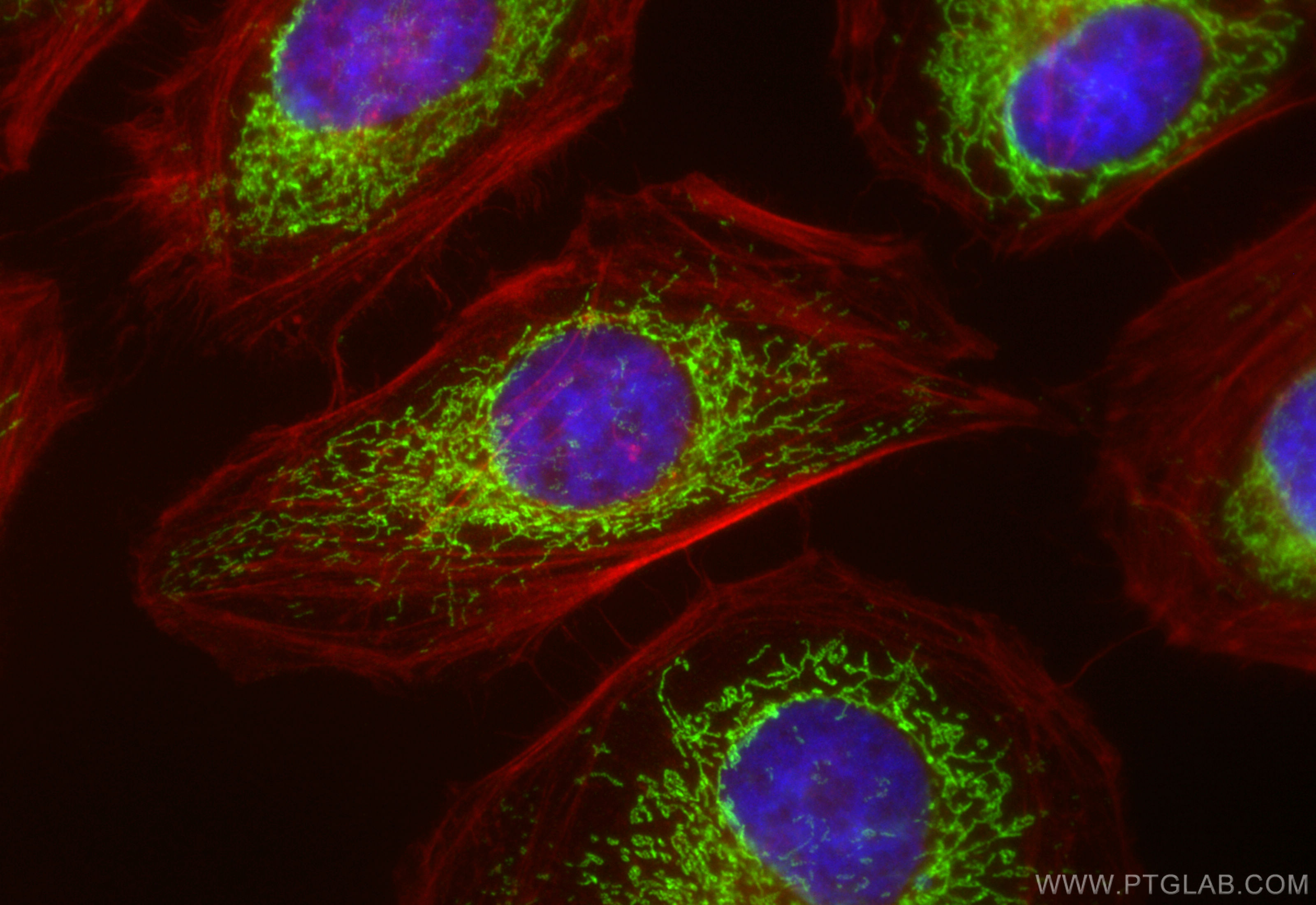 IF Staining of HeLa using 84031-5-RR