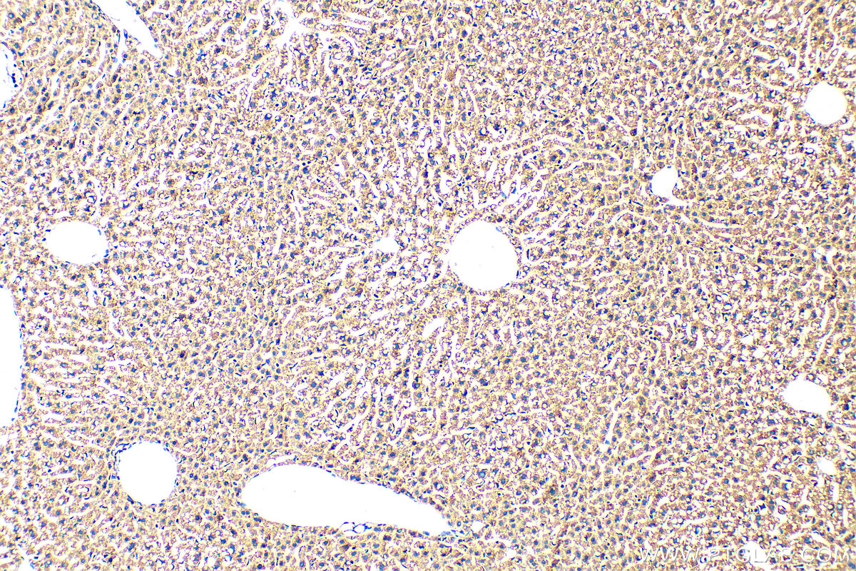 IHC staining of mouse liver using 11366-1-AP