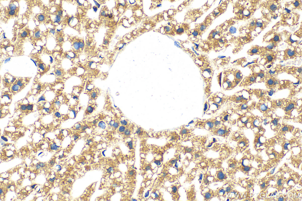 IHC staining of mouse liver using 11366-1-AP