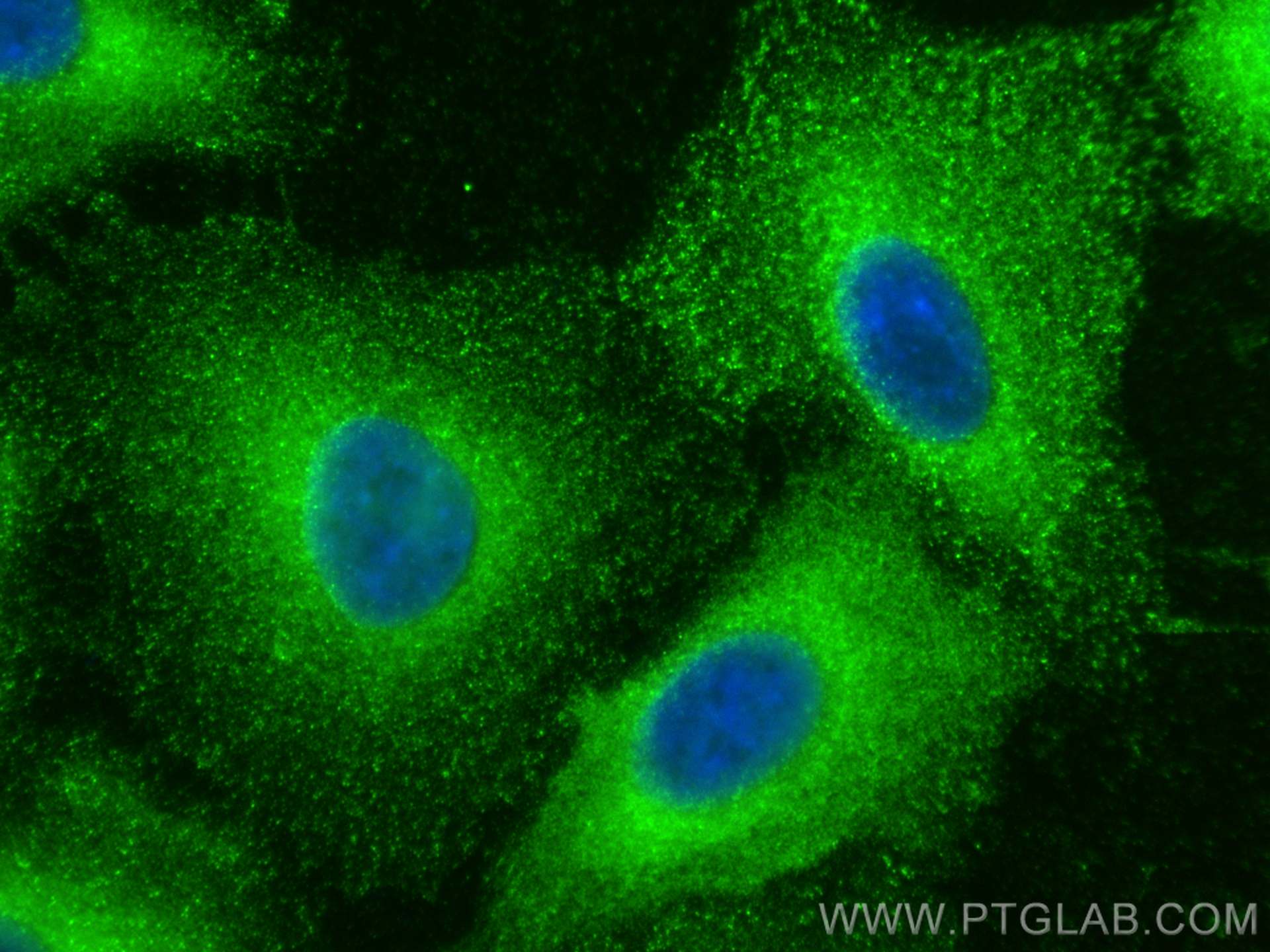 IF Staining of A549 using 22231-1-AP