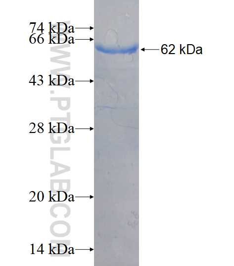 HIP1 fusion protein Ag17576 SDS-PAGE