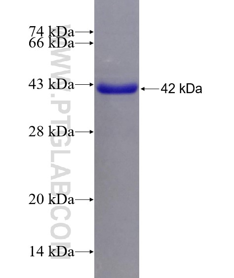 HIP1 fusion protein Ag17982 SDS-PAGE