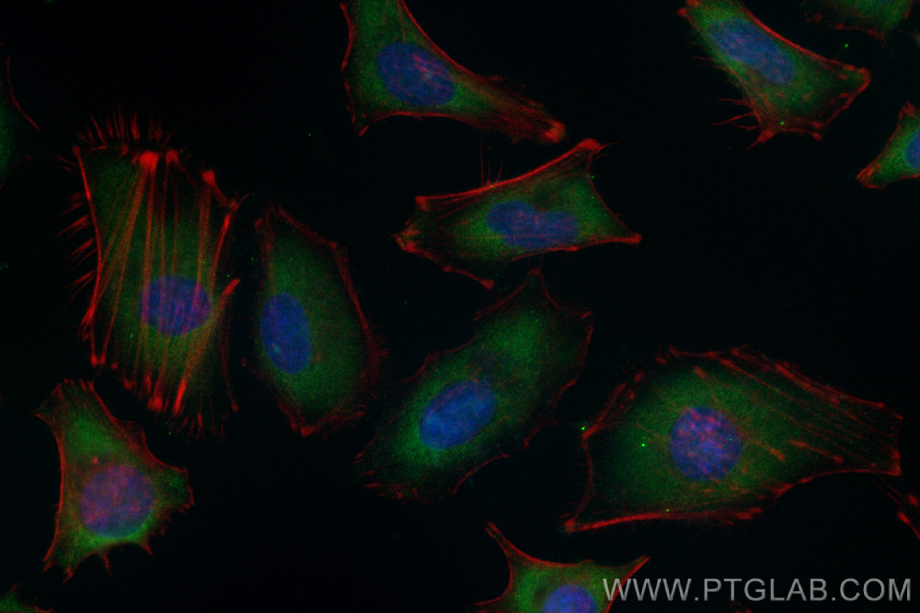 IF Staining of HeLa using CL488-68403