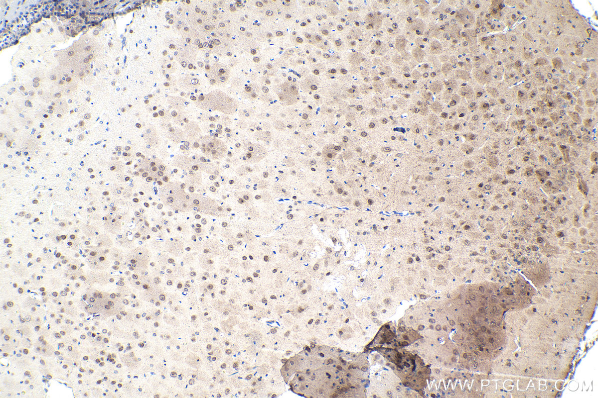 IHC staining of rat brain using 55408-1-AP