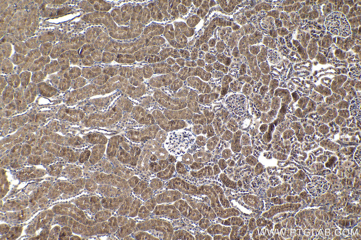 IHC staining of rat kidney using 55408-1-AP