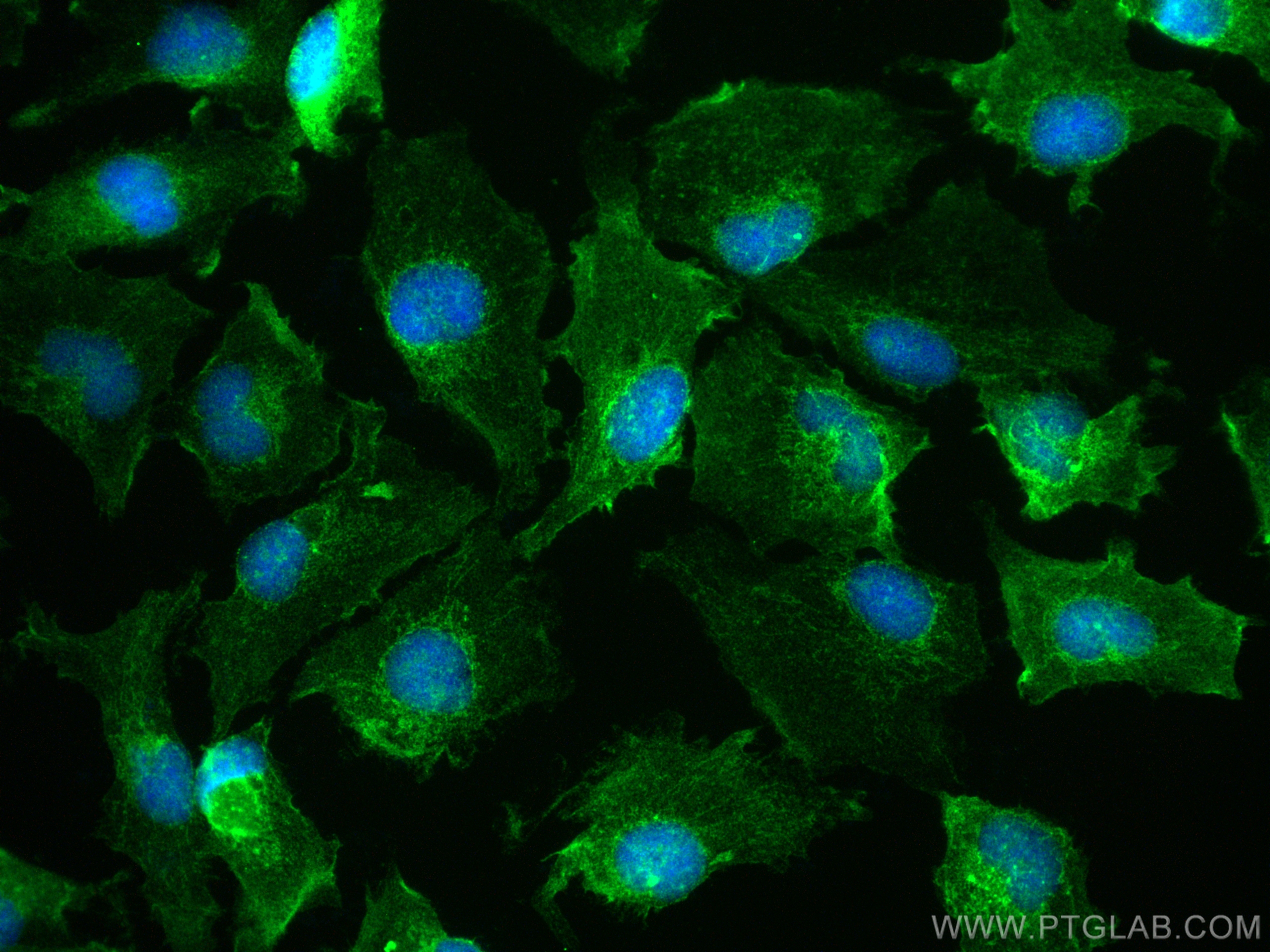 IF Staining of U-251 using 14331-1-AP