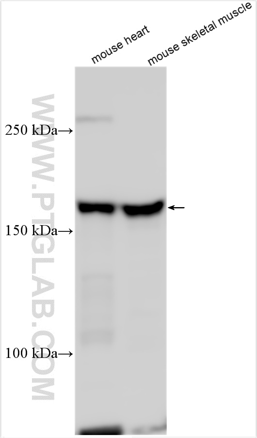 WB analysis using 14331-1-AP