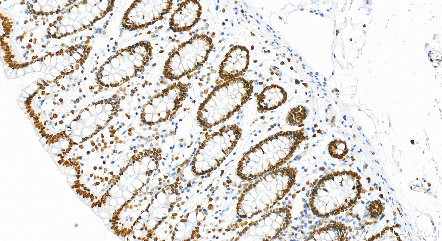 IHC staining of human colon using 18093-1-AP