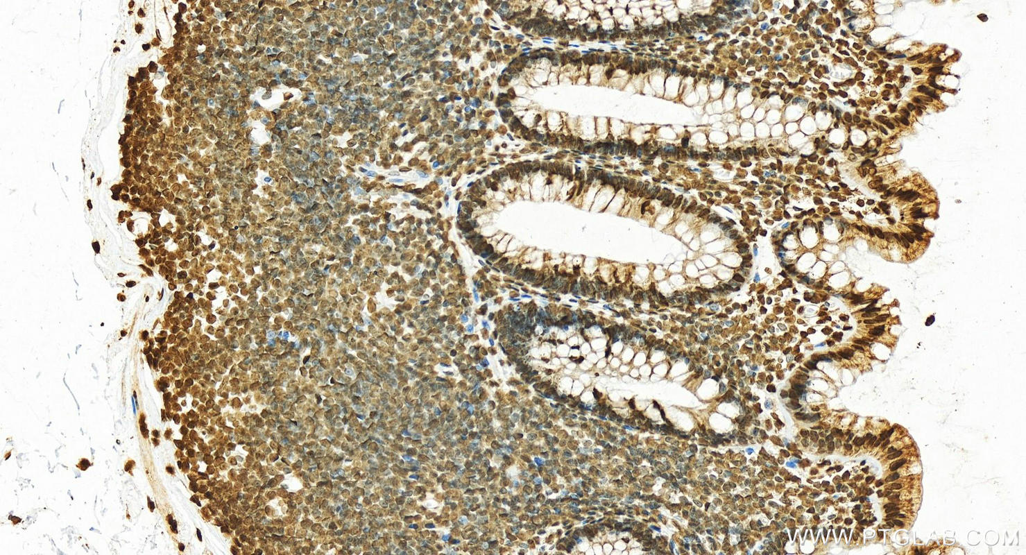 IHC staining of human normal colon using 19649-1-AP